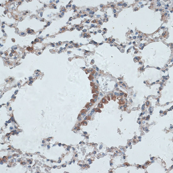 Immunohistochemistry of paraffin-embedded Mouse lung using PMEPA1 Polyclonal Antibody at dilution of  1:100 (40x lens).