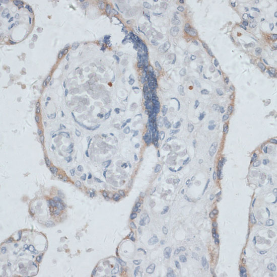 Immunohistochemistry of paraffin-embedded Human placenta using DTNBP1 Polyclonal Antibody at dilution of  1:100 (40x lens).