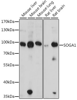 Western blot analysis of extracts of various cell lines using SOGA1 Polyclonal Antibody at dilution of 1:1000.