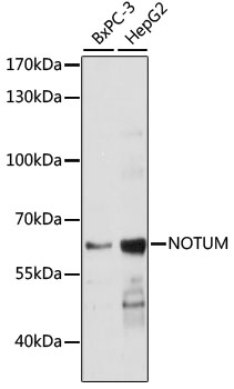 Western blot analysis of extracts of various cell lines using NOTUM Polyclonal Antibody at dilution of 1:1000.