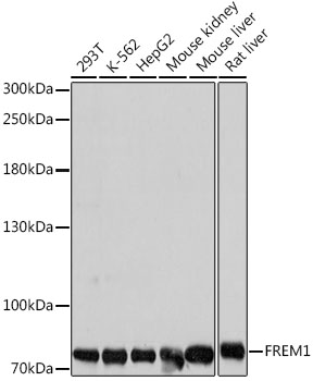 Western blot analysis of extracts of various cell lines using FREM1 Polyclonal Antibody at dilution of 1:1000.