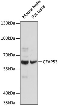 Western blot analysis of extracts of various cell lines using CFAP53 Polyclonal Antibody at dilution of 1:1000.