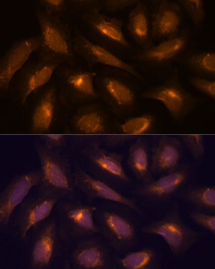 Immunofluorescence analysis of U-2 OS cells using TXNRD1 Polyclonal Antibody at dilution of  1:100. Blue: DAPI for nuclear staining.