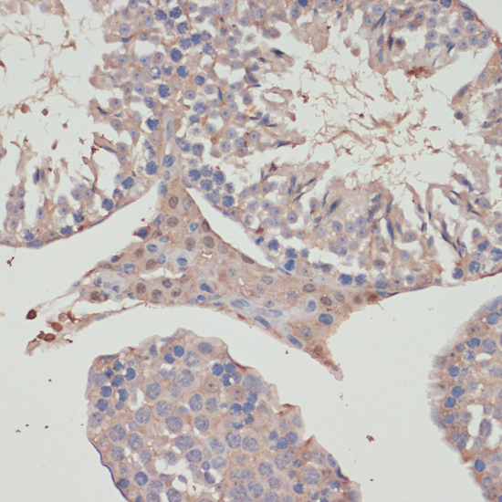 Immunohistochemistry of paraffin-embedded Mouse testis using TXNRD1 Polyclonal Antibody at dilution of  1:100 (40x lens).