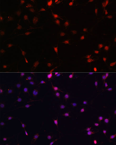 Immunofluorescence analysis of C6 cells using c-Fos Polyclonal Antibody at dilution of  1:100. Blue: DAPI for nuclear staining.
