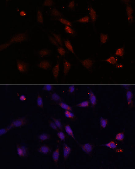 Immunofluorescence analysis of NIH/3T3 cells using c-Fos Polyclonal Antibody at dilution of  1:100. Blue: DAPI for nuclear staining.
