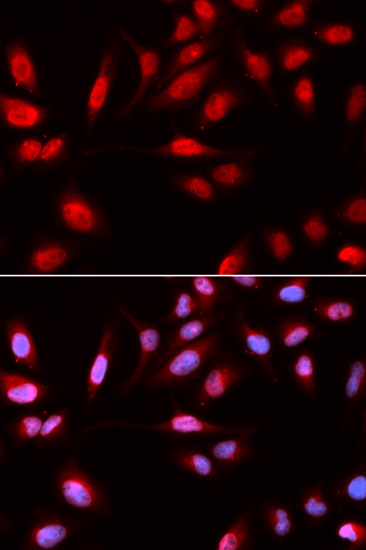 Immunofluorescence analysis of U2OS cells using PDPK1 Polyclonal Antibody