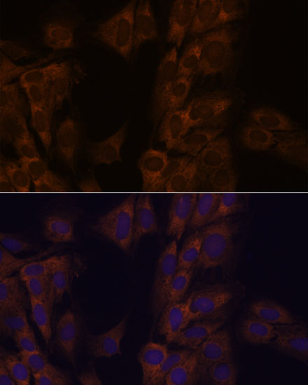 Immunofluorescence analysis of C6 cells using ATXN2 Polyclonal Antibody at dilution of  1:100. Blue: DAPI for nuclear staining.