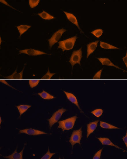 Immunofluorescence analysis of L929 cells using ATXN2 Polyclonal Antibody at dilution of  1:100. Blue: DAPI for nuclear staining.