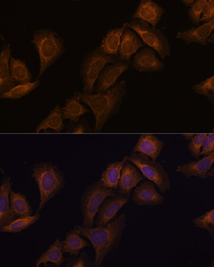 Immunofluorescence analysis of U-2 OS cells using ATXN2 Polyclonal Antibody at dilution of  1:100. Blue: DAPI for nuclear staining.