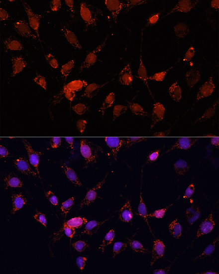 Immunofluorescence analysis of C6 cells using EIF4EBP1 Polyclonal Antibody at dilution of  1:100 (40x lens). Blue: DAPI for nuclear staining.