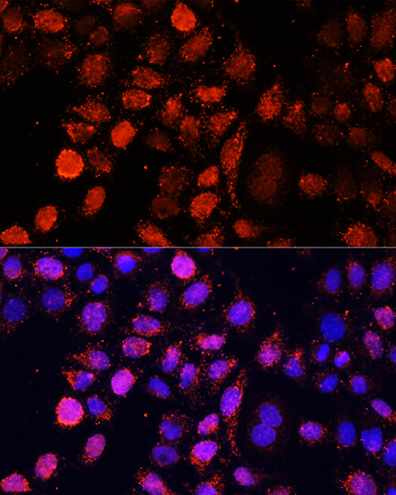 Immunofluorescence analysis of HeLa cells using EIF4EBP1 Polyclonal Antibody at dilution of  1:100 (40x lens). Blue: DAPI for nuclear staining.