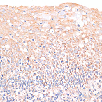 Immunohistochemistry of paraffin-embedded Human tonsil using EIF4EBP1 Polyclonal Antibody at dilution of  1:100 (40x lens).