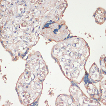 Immunohistochemistry of paraffin-embedded Human placenta using ASC / TMS1 Polyclonal Antibody at dilution of  1:100 (40x lens).