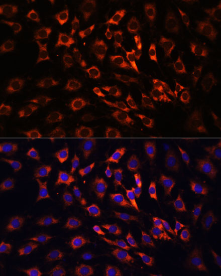 Immunofluorescence analysis of C6 cells using ERK1 / ERK2 Polyclonal Antibody at dilution of  1:100 (40x lens). Blue: DAPI for nuclear staining.