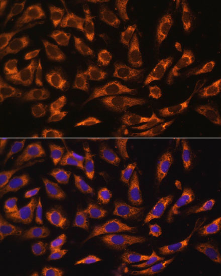 Immunofluorescence analysis of U-2 OS cells using ERK1 / ERK2 Polyclonal Antibody at dilution of  1:100 (40x lens). Blue: DAPI for nuclear staining.