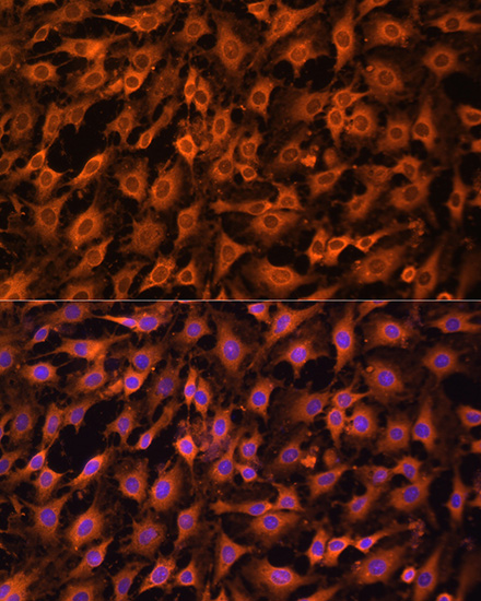 Immunofluorescence analysis of C6 cells using ERK1 / ERK2 Polyclonal Antibody at dilution of  1:100. Blue: DAPI for nuclear staining.