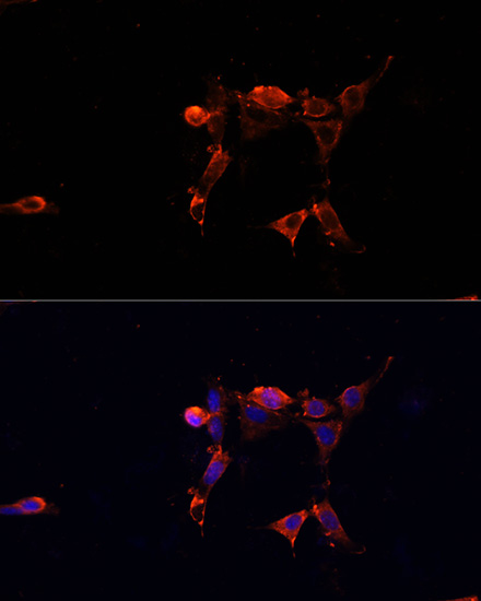 Immunofluorescence analysis of NIH/3T3 cells using ERK1 / ERK2 Polyclonal Antibody at dilution of  1:100. Blue: DAPI for nuclear staining.