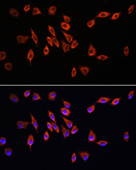 Immunofluorescence analysis of L929 cells using NRP1 Polyclonal Antibody at dilution of  1:100. Blue: DAPI for nuclear staining.