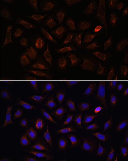 Immunofluorescence analysis of U-2 OS cells using NRP1 Polyclonal Antibody at dilution of  1:100. Blue: DAPI for nuclear staining.