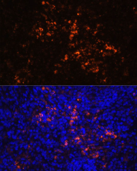 Immunofluorescence analysis of Rat spleen using CD70 Polyclonal Antibody at dilution of  1:100 (40x lens). Blue: DAPI for nuclear staining.