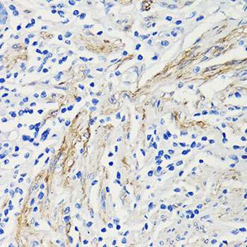 Immunohistochemistry of paraffin-embedded Human colon using CCL4 Polyclonal Antibody at dilution of  1:100 (40x lens).