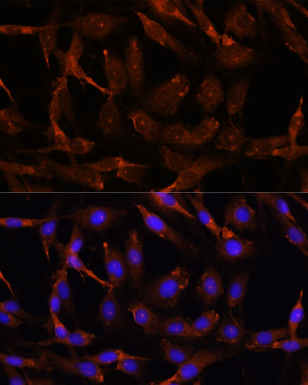 Immunofluorescence analysis of C6 cells using WNT10B Polyclonal Antibody at dilution of  1:100. Blue: DAPI for nuclear staining.