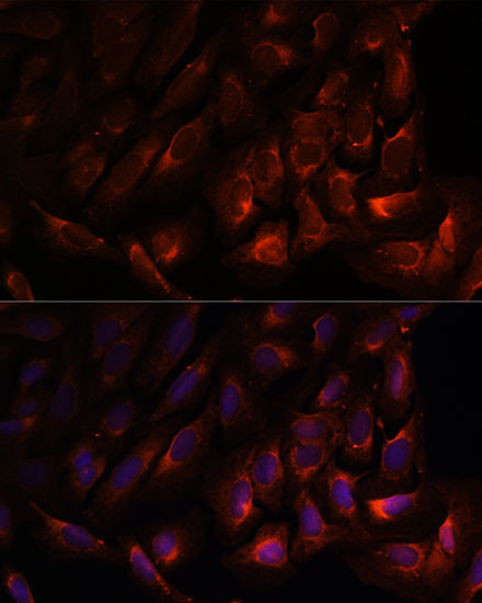 Immunofluorescence analysis of U-2 OS cells using WNT10B Polyclonal Antibody at dilution of  1:100. Blue: DAPI for nuclear staining.