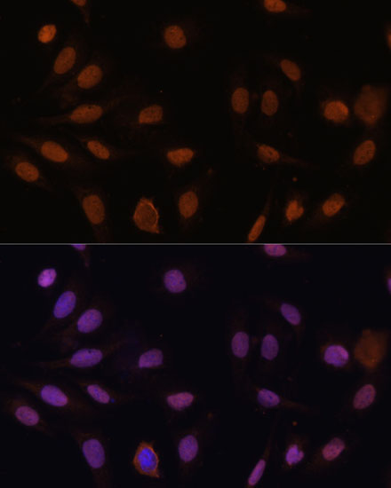 Immunofluorescence analysis of U-2 OS cells using p27 KIP 1 Polyclonal Antibody at dilution of  1:100 (40x lens). Blue: DAPI for nuclear staining.