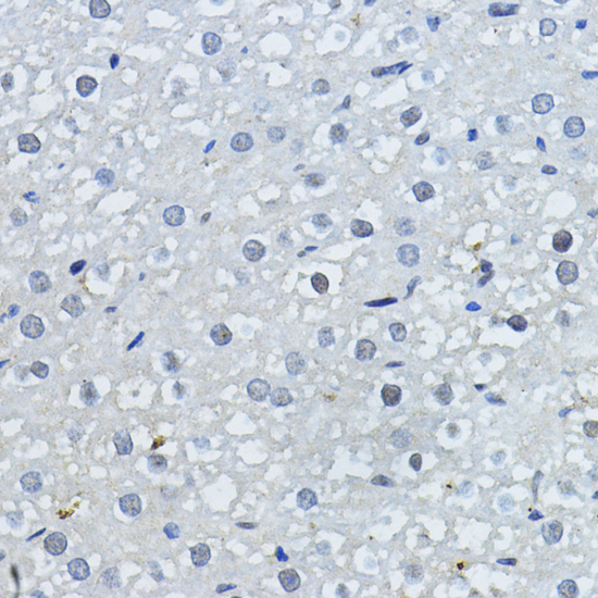 Immunohistochemistry of paraffin-embedded Rat liver using p27 KIP 1 Polyclonal Antibody at dilution of  1:200 (40x lens).