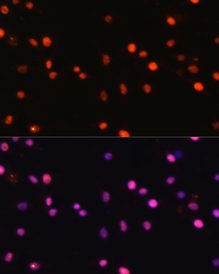 Immunofluorescence analysis of C6 cells using DNMT1 Polyclonal Antibody at dilution of  1:100. Blue: DAPI for nuclear staining.