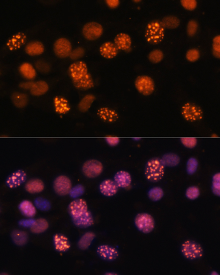 Immunofluorescence analysis of NIH/3T3 cells using DNMT1 Polyclonal Antibody at dilution of  1:100. Blue: DAPI for nuclear staining.