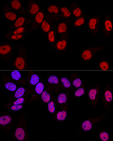 Confocal immunofluorescence analysis of HeLa cells using DNMT1 Polyclonal Antibody at dilution of  1:100. Blue: DAPI for nuclear staining.