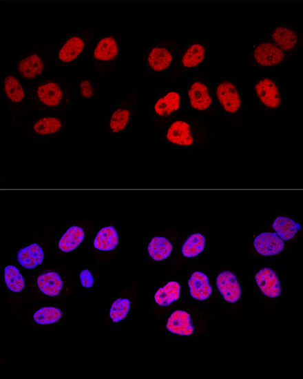 Confocal immunofluorescence analysis of HeLa cells using DNMT1 Polyclonal Antibody at dilution of  1:100. Blue: DAPI for nuclear staining.