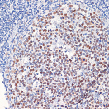 Immunohistochemistry of paraffin-embedded Human tonsil using DNMT1 Polyclonal Antibody at dilution of  1:200 (40x lens).