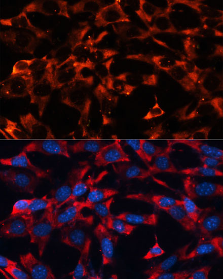 Immunofluorescence analysis of NIH-3T3 cells using MAPK1/MAPK3 Polyclonal Antibody at dilution of  1:100 (40x lens). Blue: DAPI for nuclear staining.