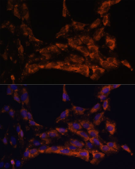 Immunofluorescence analysis of C6 cells using IL18 Polyclonal Antibody at dilution of  1:100. Blue: DAPI for nuclear staining.
