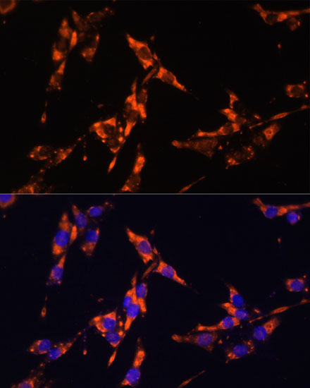 Immunofluorescence analysis of HeLa cells using IL18 Polyclonal Antibody at dilution of  1:100. Blue: DAPI for nuclear staining.
