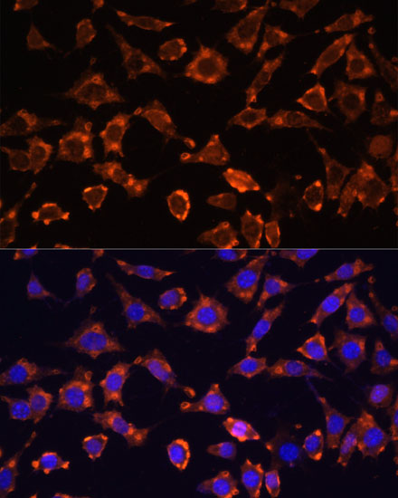 Immunofluorescence analysis of L929 cells using IL18 Polyclonal Antibody at dilution of  1:100. Blue: DAPI for nuclear staining.