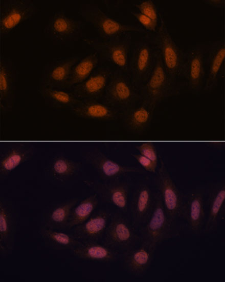 Immunofluorescence analysis of U-2 OS cells using SNIP1 Polyclonal Antibody at dilution of  1:100. Blue: DAPI for nuclear staining.