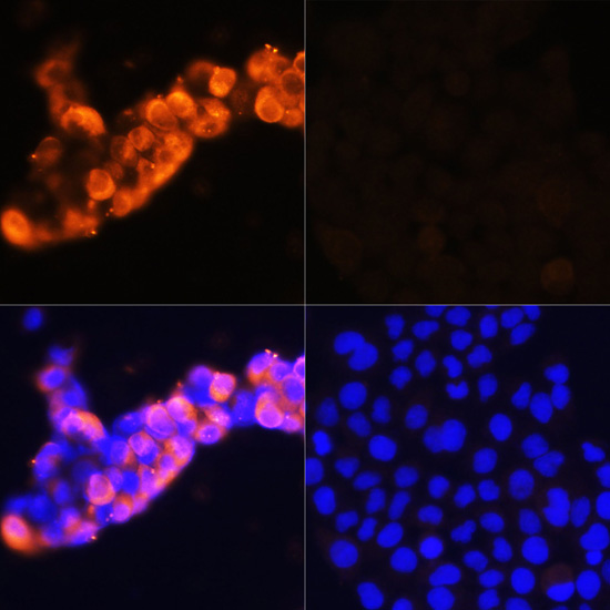 Immunofluorescence analysis of HepG2 cells (upper left) and LO2 cells (negative sample control) (upper right) using AFP Polyclonal Antibody at dilution of  1:100. Blue: DAPI for nuclear staining.