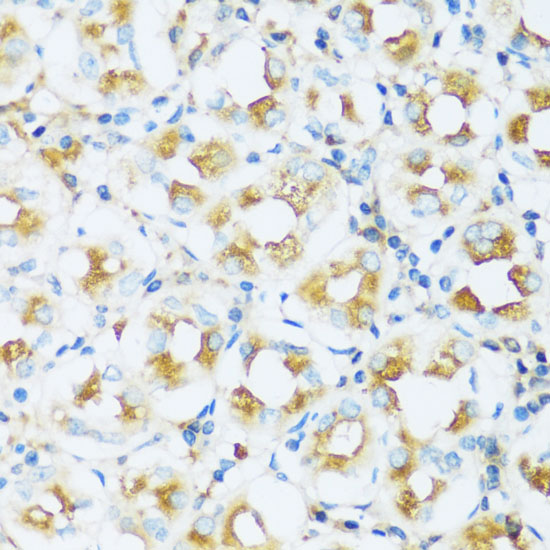 Immunohistochemistry of paraffin-embedded Human stomach using APOD Polyclonal Antibody at dilution of  1:100 (40x lens).