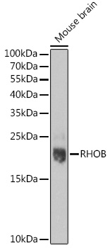 Western blot analysis of extracts of Mouse brain using RHOB Polyclonal Antibody at dilution of 1:1000.