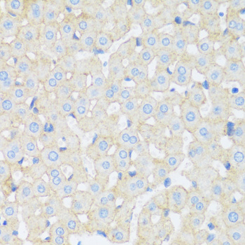 Immunohistochemistry of paraffin-embedded Rat liver using ASGR1 Polyclonal Antibody at dilution of  1:100 (40x lens).