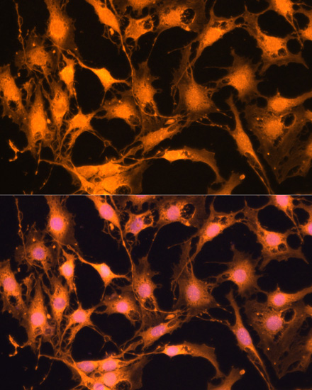 Immunofluorescence analysis of C6 cells using Caspase-3 Polyclonal Antibody at dilution of  1:100. Blue: DAPI for nuclear staining.