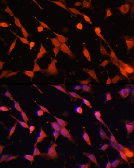 Immunofluorescence analysis of NIH/3T3 cells using Caspase-3 Polyclonal Antibody at dilution of  1:100. Blue: DAPI for nuclear staining.