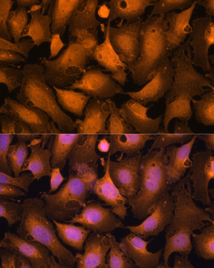 Immunofluorescence analysis of U-2OS cells using Caspase-3 Polyclonal Antibody at dilution of  1:100. Blue: DAPI for nuclear staining.