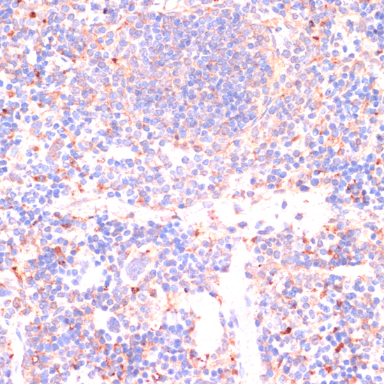Immunohistochemistry of paraffin-embedded Mouse spleen using Caspase-3 Polyclonal Antibody at dilution of  1:200 (40x lens).