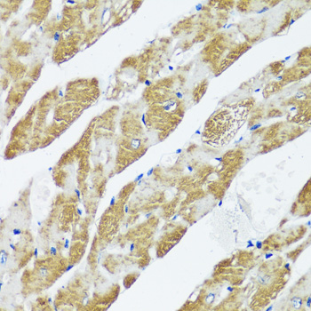 Immunohistochemistry of paraffin-embedded Mouse heart using CASQ2 Polyclonal Antibody at dilution of  1:100 (40x lens).