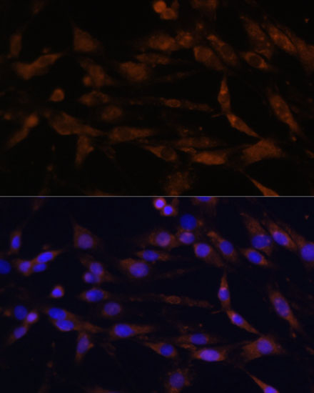 Immunofluorescence analysis of C6 cells using CD44 Polyclonal Antibody at dilution of  1:100. Blue: DAPI for nuclear staining.